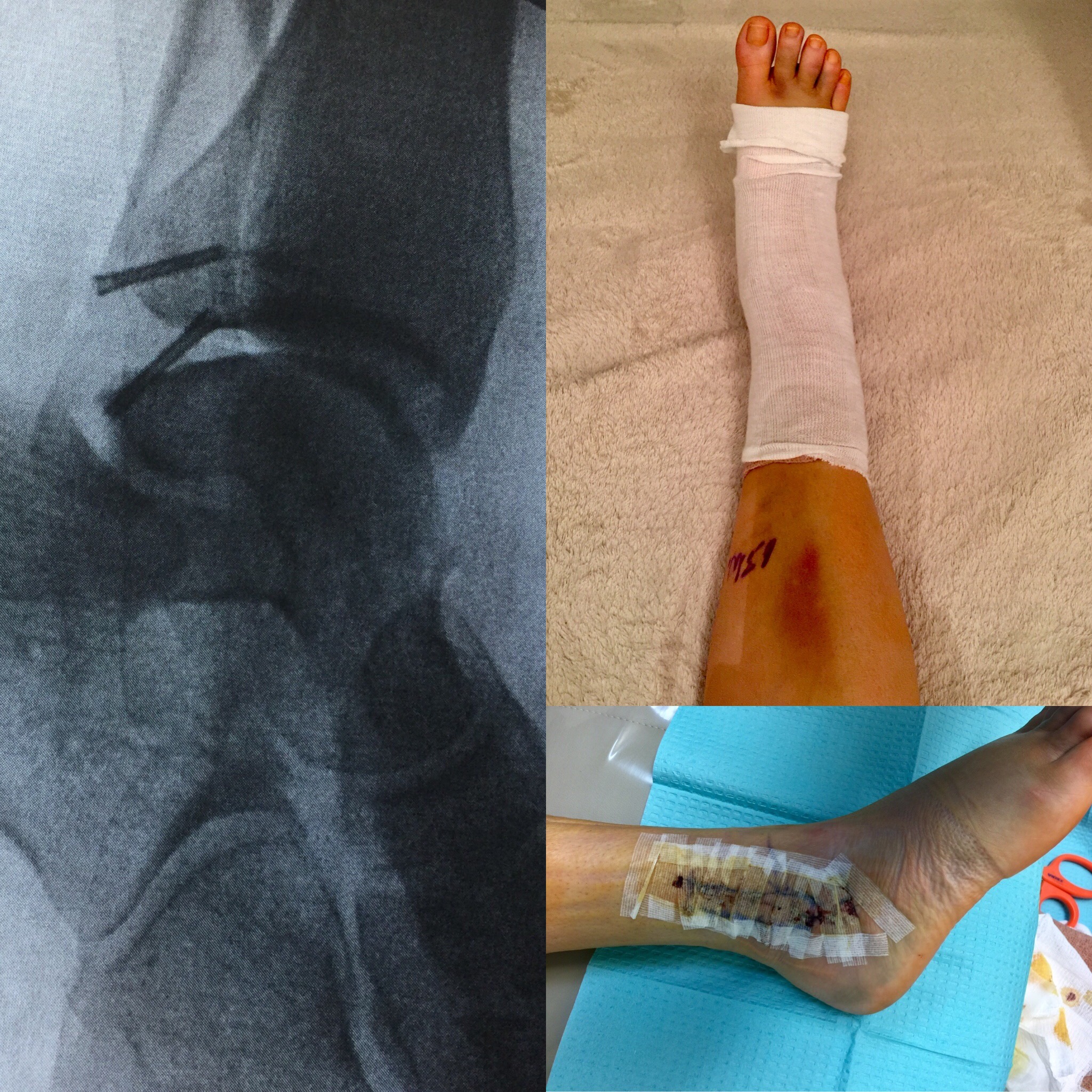 CC8DDEEA-4718-463F-ADC1-0B3449584AE6